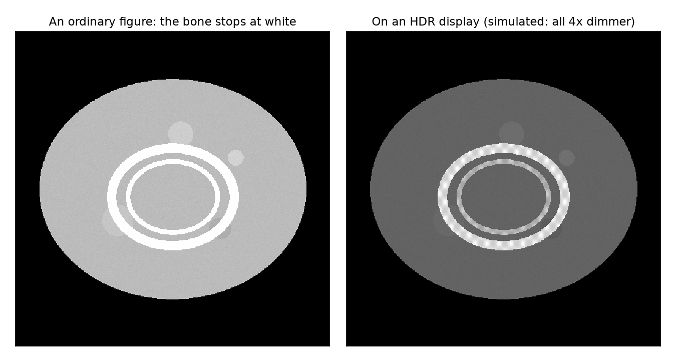 Two panels of a synthetic CT phantom. Left, the ordinary figure: the bone ring is flat white. Right, a simulation of an HDR display, all four times dimmer: the bone ring shows its texture.